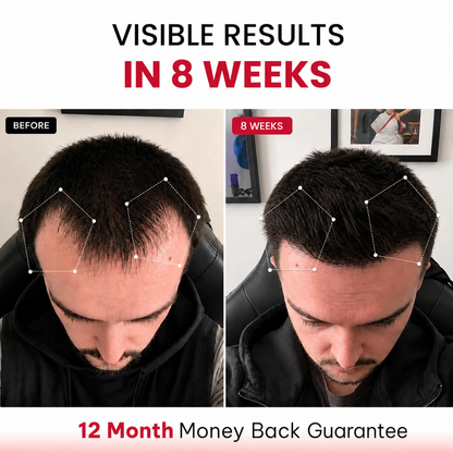 RLAVIS LUMEN™ Hair Reactivation Cap