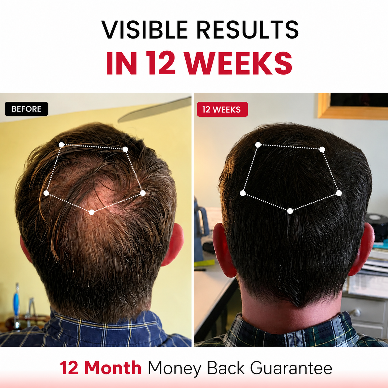 RLAVIS LUMEN™ Hair Reactivation Cap