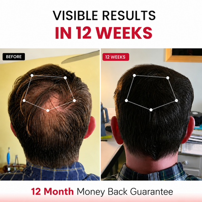 RLAVIS LUMEN™ Hair Reactivation Cap