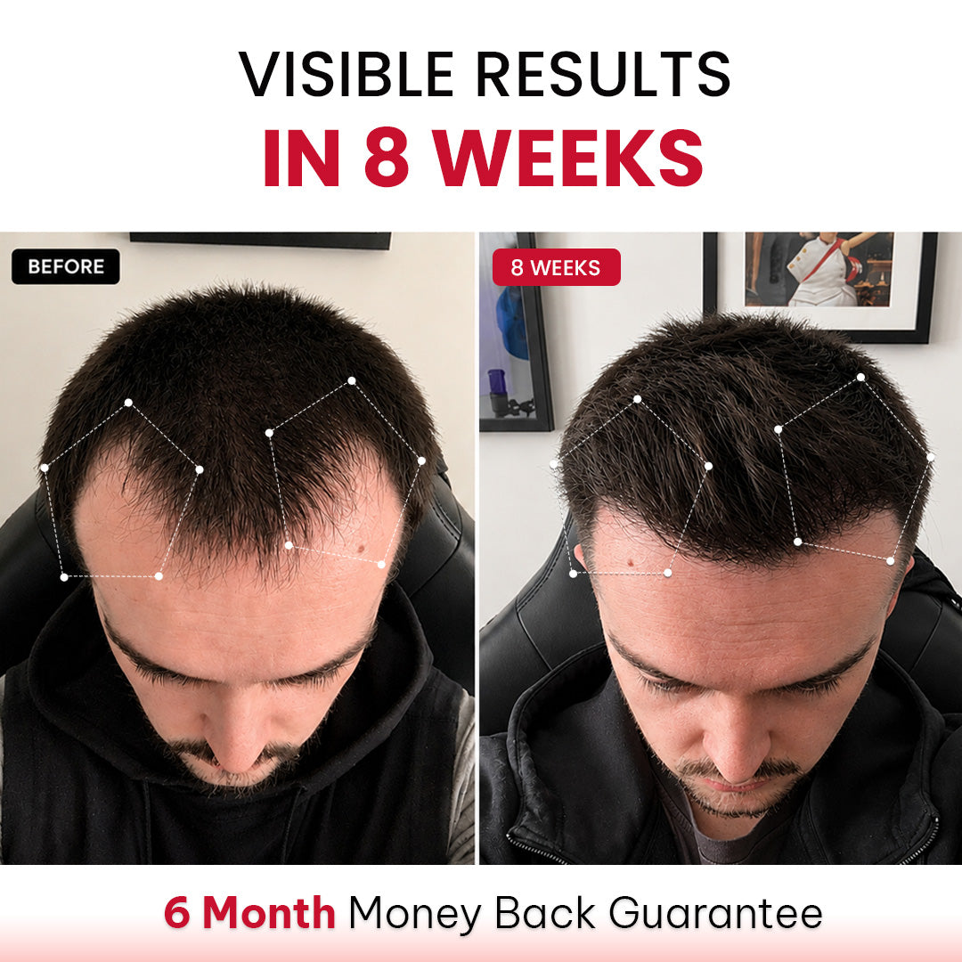 RLAVIS LUMEN™ Hair Reactivation Cap