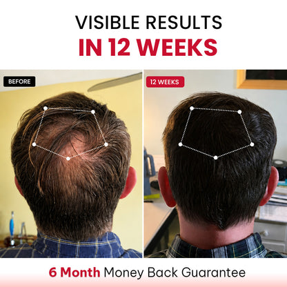 RLAVIS LUMEN™ Hair Reactivation Cap
