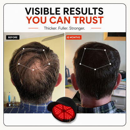 RLAVIS™ Red Light Therapy Cap