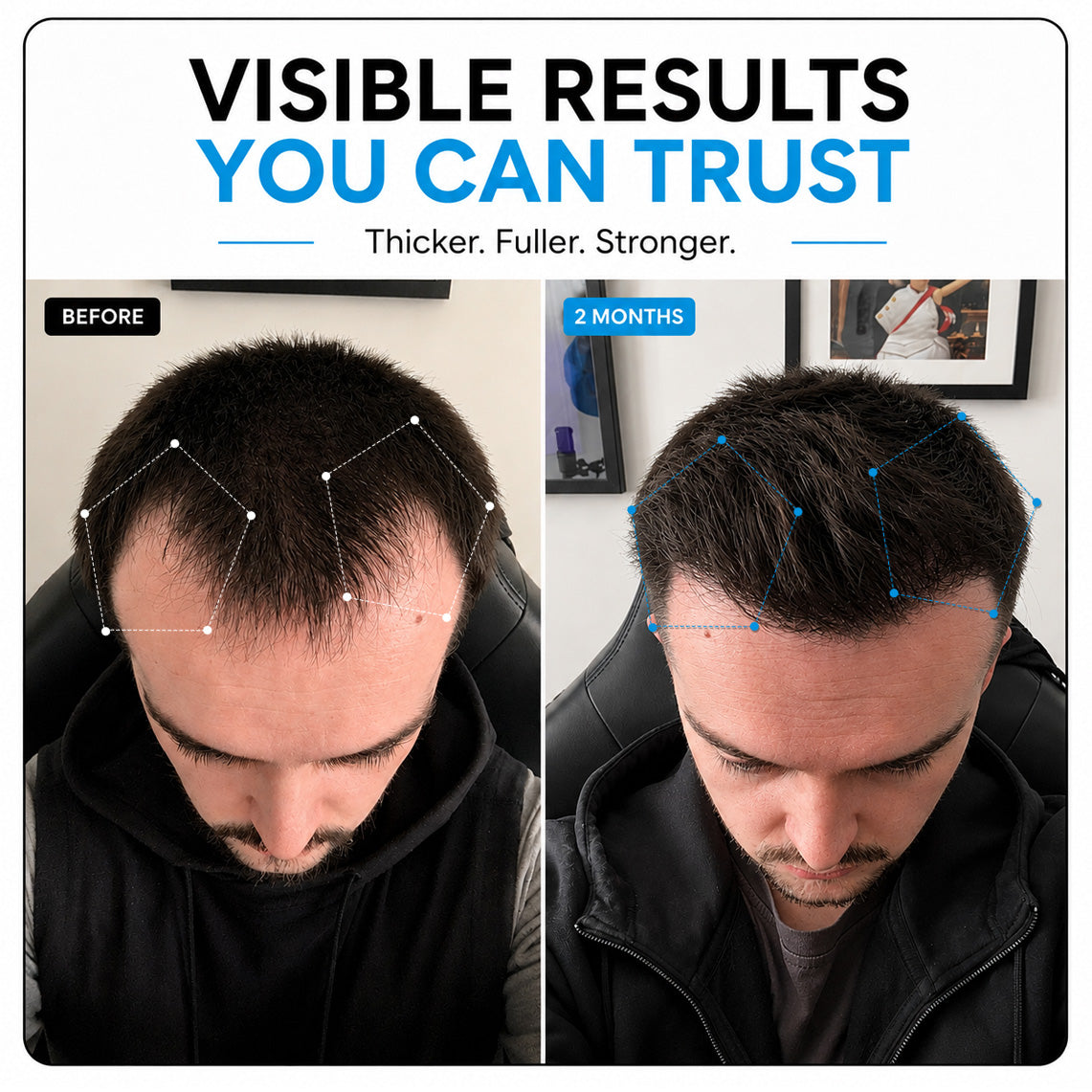 RLAVIS LUMEN™ Hair Reactivation Cap