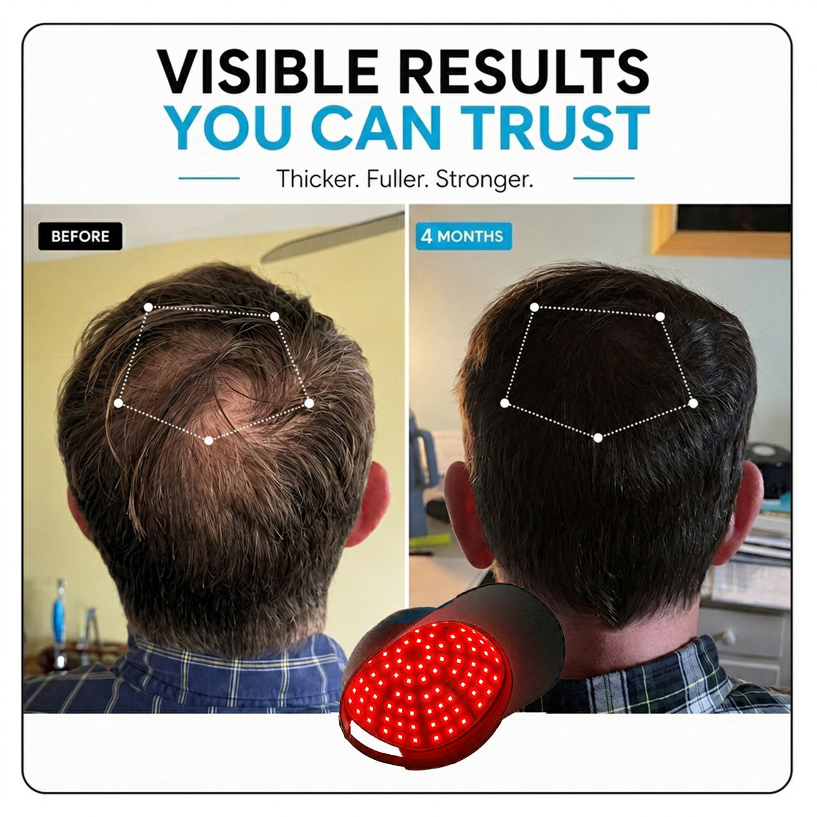 RLAVIS LUMEN™ Hair Reactivation Cap